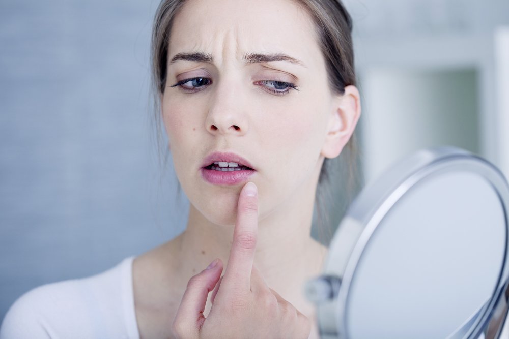 Лечение простуды на губах: важна каждая минута!