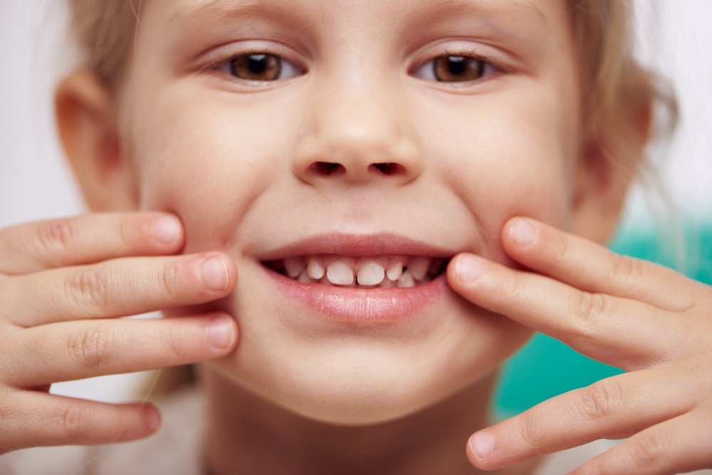 Травмы эмали зубов у детей