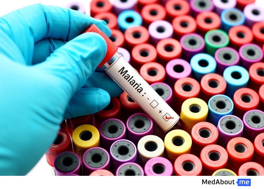 Лабораторные анализы при малярии